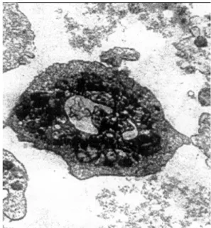 Fig. 1a  –  The ultrastructural (electron microscopy) prop- prop-erties of cryopreserved platelets