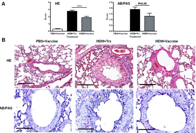 Fig 6. Pulmonary inflammation induced in mice by house dust mite is attenuated by vaccination against IL-33