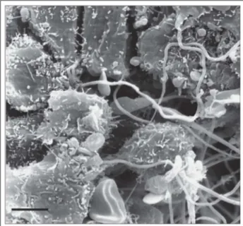 Abbildung 1: Kanalartige Lücken zwischen den Corona-radiata-Zellen leiten die Spermatozoen zur Oozyte (Balken = 5 µm).