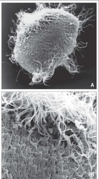 Abbildung 6: Vertikale Bindung von Spermatozoen auf der Zona pellucida. Der Spermatozoenkopf liegt in der porösen Oberfläche der Zona (Balken = 2 µm).