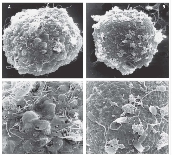 Abbildung 7a und 7b: Spermatozoenbindung an einer In-vivo- (7a) und In-vitro-Blastozyste (7b) vom Schwein.
