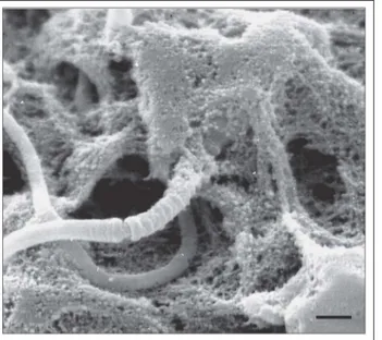 Abbildung 9: Filamentös erscheinende, extrazelluläre Matrix überwu- überwu-chert den Kopf eines Spermatozoons auf der Zona pellucida (Balken = 1 µm).