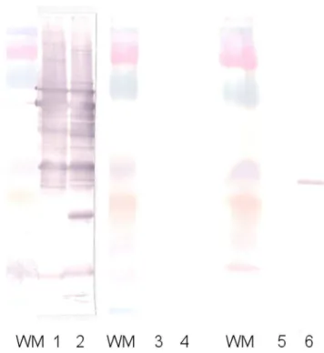Fig. 1. Western blot performed from the first patient’s serum before and after cross-adsorption