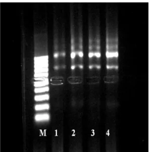 Figura  6.    Gel  de  agarose  a  1%,  mostrando  a  corrida  eletroforética  do  RNA  total extraído  da  região  embrionária  de  sementes  de  Solanum  lycocarpum