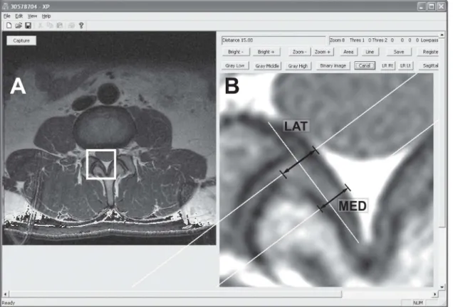Fig 1. Screen capture of the image analysis program interface. (A) An original PD MR image