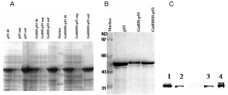 Figure 1.  The expression and purification of GnRH-p53 and GnRH III-p53.  (A) The expression of GnRH-p53 and GnRH III-p53 in  E.coli  analized  by  SDS-PAGE(12%)