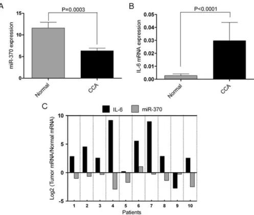 Figure 1. miR-370 and IL-6 are inversely correlated in human CCA. A. miR-370 is downregulated in human CCA vs