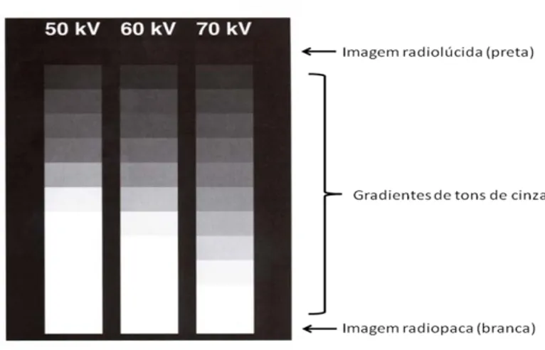 Figura 12 – Gradiente de tons de cinza gerado pelos de raios X em aparelhos com  fatores físicos diversos (Arquivos da disciplina de Radiologia Odontológica, UFSC)