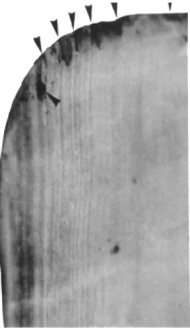 Figure  5.  Latero-anterior  detail  of  the  ventral  face  of  the  nail,  sho-  wing  the  well  developed  furrows  of  the  nail  bed  and  the  well  roun-  ded  edges  of  tip