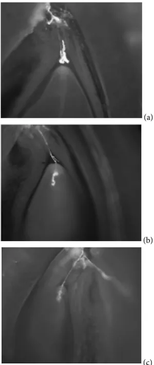 Figure 1. Unusual behavior of growing pollen tubes in the  ovary of the plum (Prunus domestica L.): a – a bundle of pollen  tubes above the nucellus; b – further growth of a pollen tube in  the embryo sac; c - fluorescence of the embryo sac