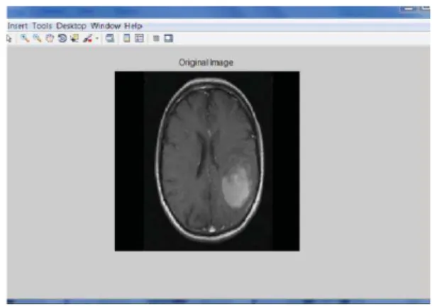Figure 2. Original Image of Brain 