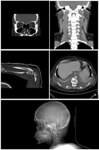 Figura 2: Exemplo de uma Imagem DICOM.