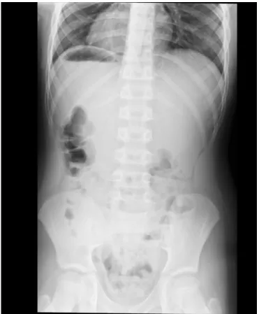 Figura 6: Exemplo de uma Imagem DICOM.