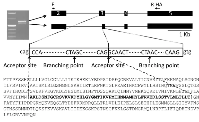 Fig 3. Different isoforms of SERPINA1F and their expression in HEK293 cell culture. A, alternative splicing of SERPINA1F that leads to double bands in gel electrophoresis of PCR product and change in protein sequence