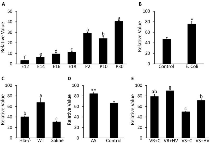 Fig 5. Expression profile in lung for CTLA2A in microarray DataSets obtained from NCBI website