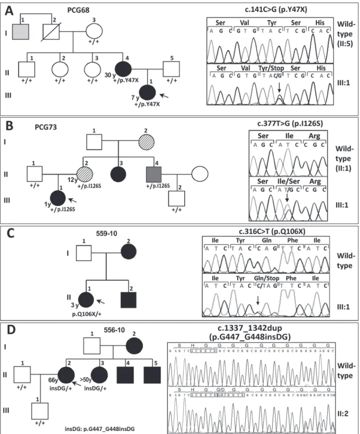 Fig 1. FOXC1 mutation segregation in families with autosomal dominant glaucoma. (A, B, C and D) Pedigrees of the families