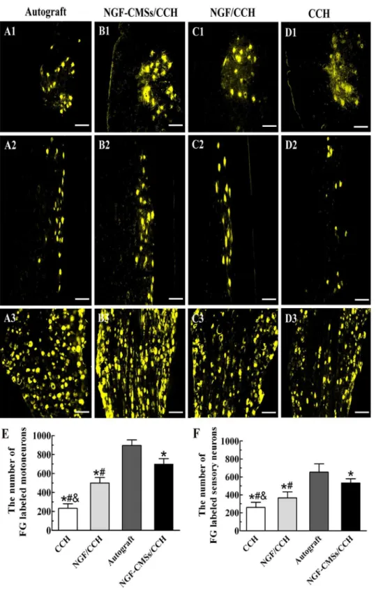 Figure 7. Fluoro-Gold (FG) retrograde tracing. Micrographs of FG-labeled motoneurons in spinal cord (transverse sections: A1, B1, C1, and D1;