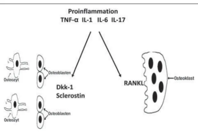 Abbildung 1: Die wesentlichen osteologischen Regulationssysteme und die zentralen  Zytokine der synovialen Proinfl ammation