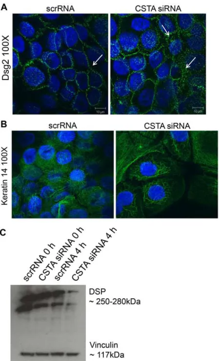Fig 5. Loss of CSTA leads to destabilized intercellular connections. Cells were treated with non- non-targeting pool scrRNA or with CSTA siRNA (CSTA KD) followed by mechanical stretching for 4 hr