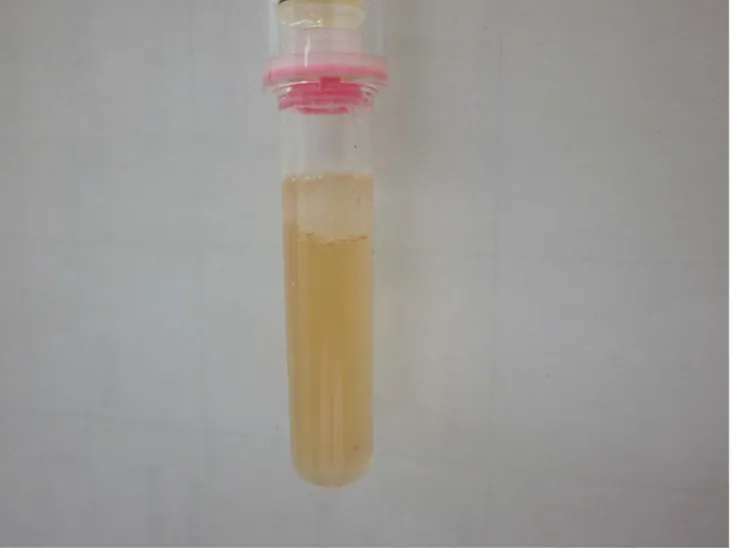 Figure 1. Example of a IsoScreen and SmokeScreen negative test result. Original urine colour (no colour change) = negative test result.