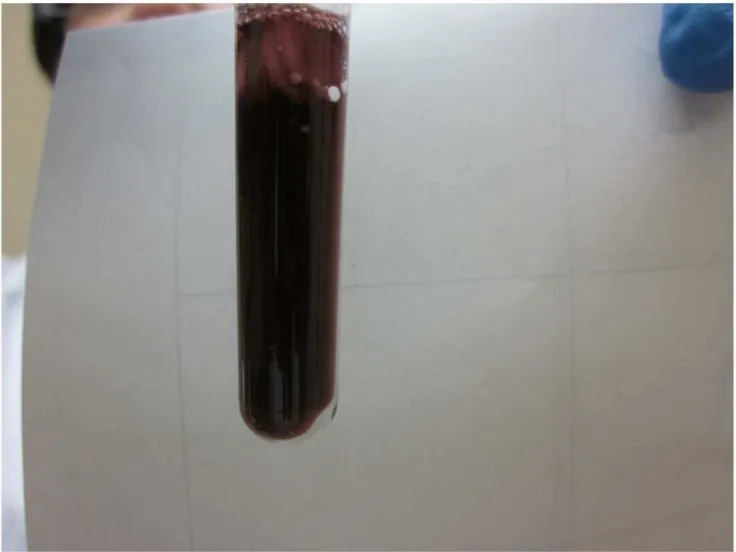Figure 2. Example of a IsoScreenpositive test result. Original urine colour (no colour change) = negative test result