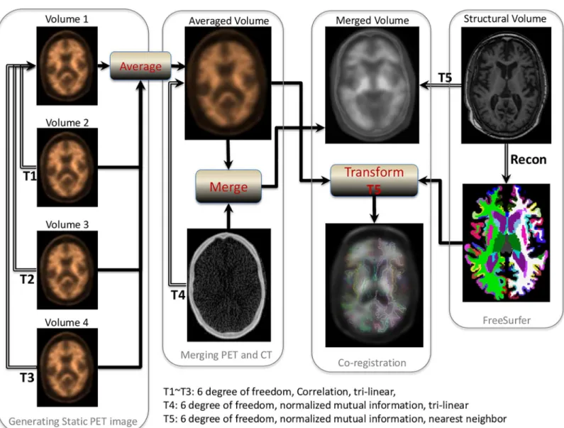 Fig 1. Procedures for quantitative PET amyloid analysis.