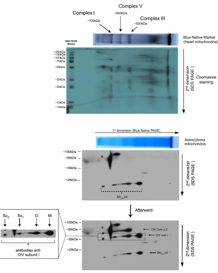 Figure 8. 2D BN/SDS-PAGE separation of native astrocytoma mitochondria protein extracts