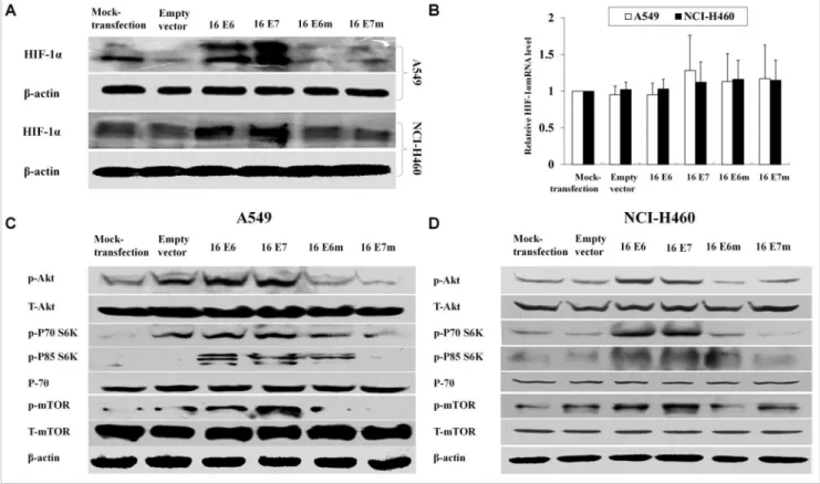 Figure 1. Effects of HPV-16 oncoproteins on HIF-1a expression and PI3K/Akt/mTOR signaling pathway activation in NSCLC cells