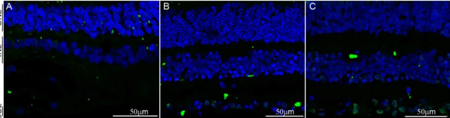 Figure 4. SFRS10 is not expressed in normal human retinae. A–C: IHC with rabbit anti-Sfrs10 (green) on sections obtained from individuals with normal retinae
