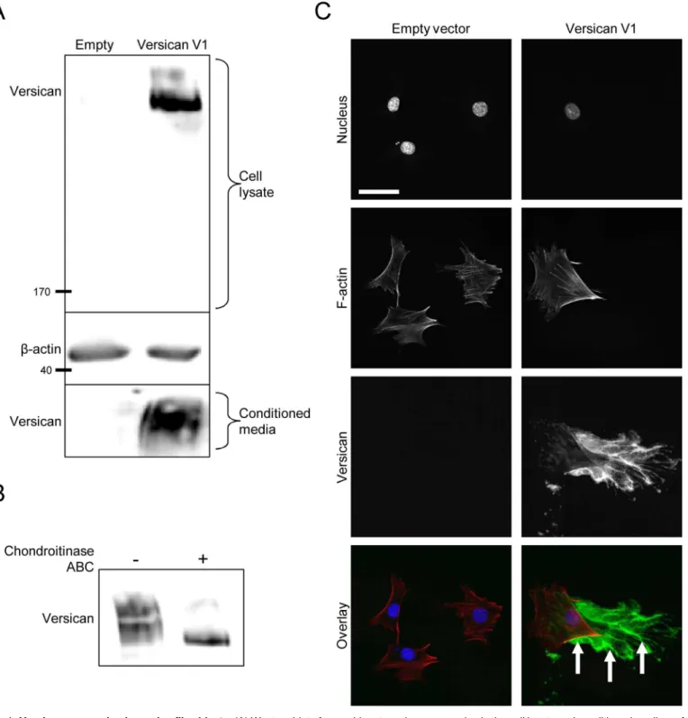 Fig 1. Versican expression in murine fibroblasts. (A) Western blot of recombinant versican expression in the cell lysate and conditioned medium of versican-transfected fibroblasts, suggesting the recombinant protein is synthesized and secreted