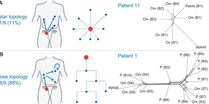Fig 3. Branching patterns in HGSOC. (A) Radial pattern of metastatic spread leads to a star topology