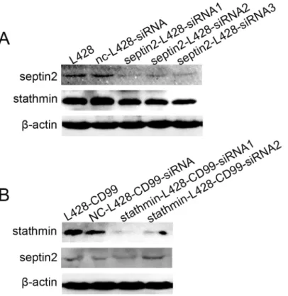 Fig 6. Correlation between SEPTIN2 and STATHMIN protein expression. (A) Protein expression levels of SEPTIN2 and STATHMIN in L428 cells transfected with SEPTIN2-siRNAs