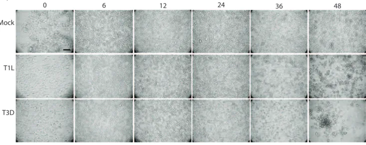Figure 2. Microscopic evaluation of HEK293 cells infected with reovirus at MOI 5. (a) photomicrographs of 293 cells mock-infected (top row), or infected with T1L (middle row) or T3D (bottom row) for various times (indicated at top)