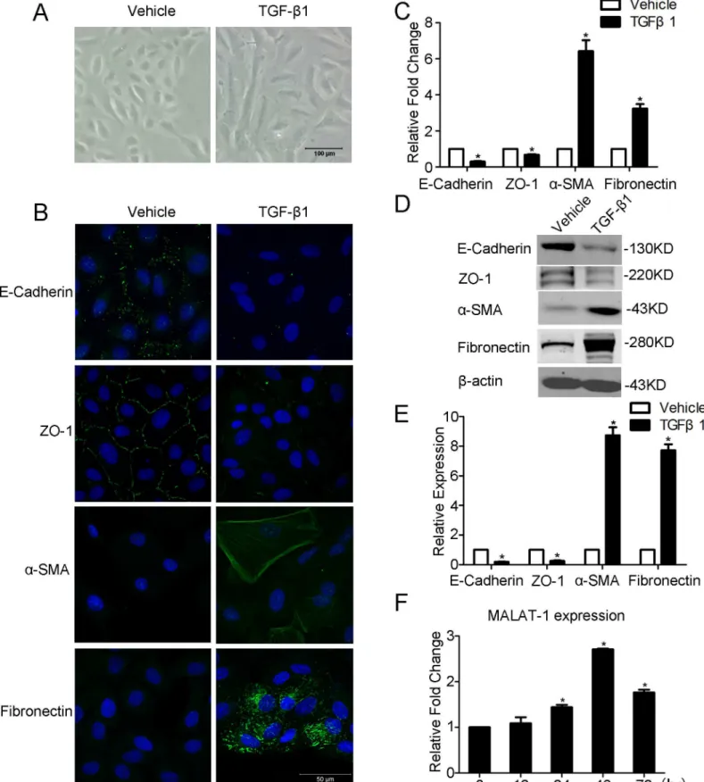 Fig 1. TGF-β1 induces EMT and MALAT1 expression in ARPE-19 cells. APRE-19 cells were incubated with TGF-β1 (10 ng/ml) for 48h