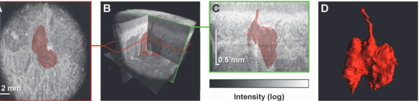Fig 2. Identification of a single LSG in a volumetric data set obtained using OCT. (A) A projection image (C-scan) extracted from the volumetric data set.