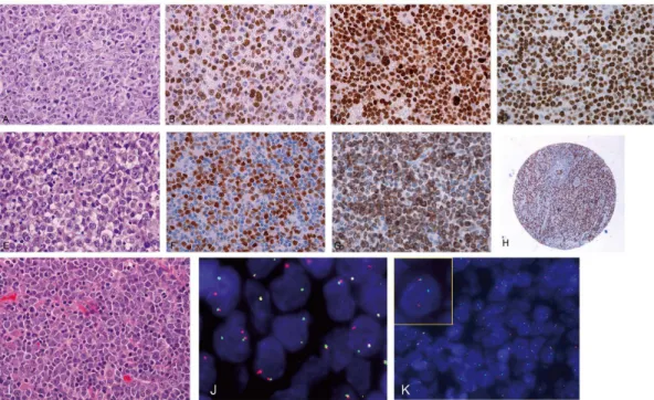 Table 2. Correlation between FISH status and MYC immunohistochemistry results.