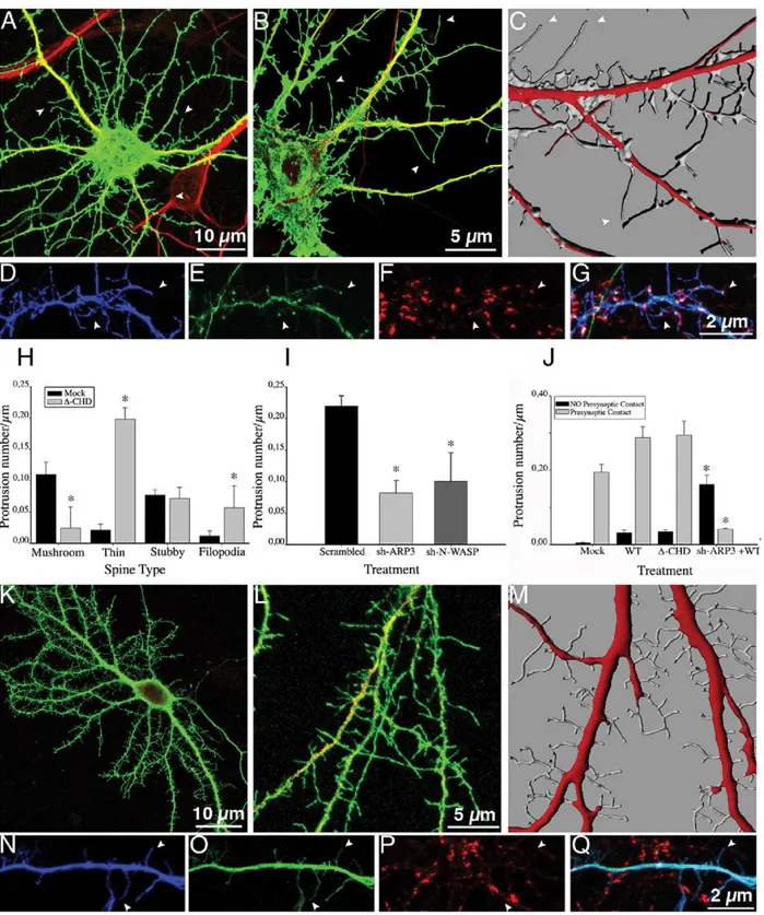 Figure 3. IQGAP1 CHD domain is required for spine head formation. (A) Confocal image showing an example of a 17 DIV cultured hippocampal neuron transfected with myc-tagged D-CHD IQGAP1 plus GFP (green) and double stained with MAP2 (red)