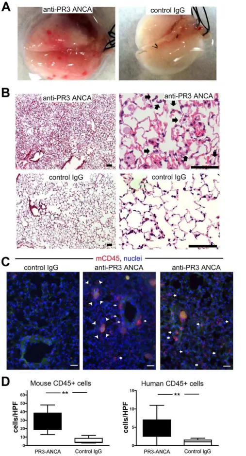 Figure 4. Anti-PR3 antibodies induce capillaritis with leukocytes of mouse and human origin