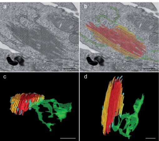 Figure 3. Continuity of the BG-like structures with the rough ER. Transfected M10 cells stably expressing YFP-Lang were processed for electron microscopy