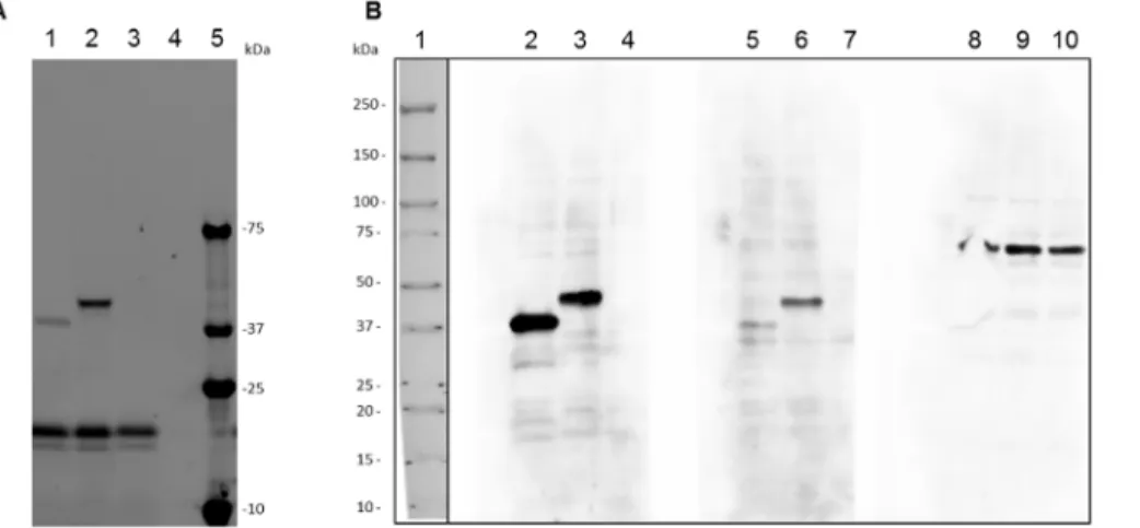 Figure 6. In vitro expression and western blotting analysis of recombinant Schistosoma mansoni major egg antigen and hemoglobinase proteins