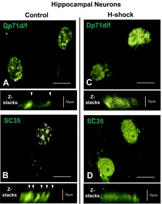 Fig 7. Localization of Dp71s in nuclear speckles of cultured hippocampal neurons. Cultured hippocampal neurons at 21 DIV were treated or non-treated with heat shock (see Materials and Methods section)