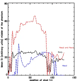 Figure  7.  Mean  SI  was  obtained  from  ten  pixels  across     the  Y-axis  for  the  middle  of  the  head,  head  and  neck,  and  body  coils;  the  dip  SI  in  the  figure  is  related  to  different  parts  of  the  inside  and  outside  phantom 