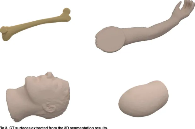 Fig 3. CT surfaces extracted from the 3D segmentation results.
