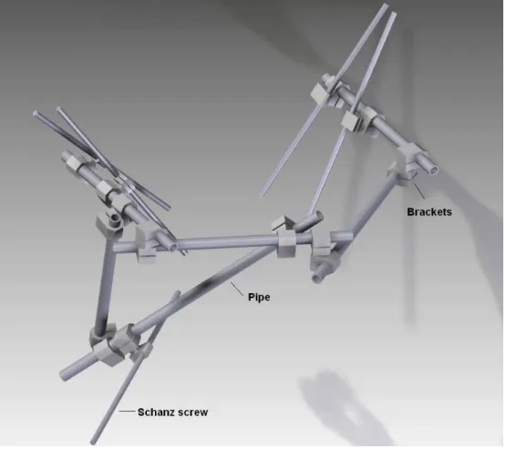 Fig. 3 CAD model of external fixator for pelvis and its acetabulum. 