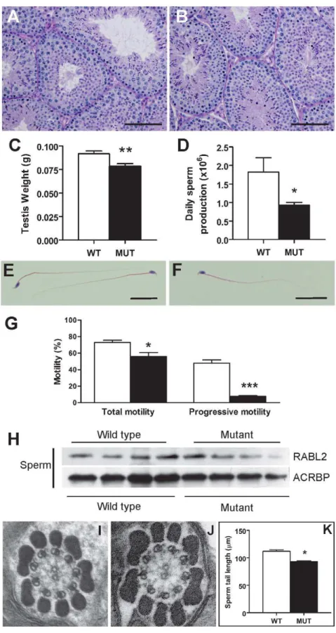 Figure 3. The sterility phenotype observed in Rabl2 Mot/Mot males. Testis histology from a 10 weeks old wild type (A) and Rabl2 Mot/Mot (B) male.