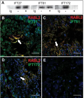 Figure 4. RABL2 binds to components of IFT complex B. (A) Immunoprecipitation of IFT complex B components (IFT27, IFT81 and IFT172) from testis extracts showed that all three were bound to RABL2.