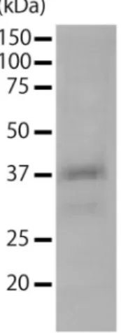 Figure 5. Structural protein of Csp07DNAV.