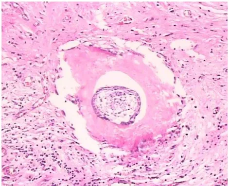 Figure 4. Immunohistochemical staining is negative for CK7 (IHC staining, original   magnification ×100) 