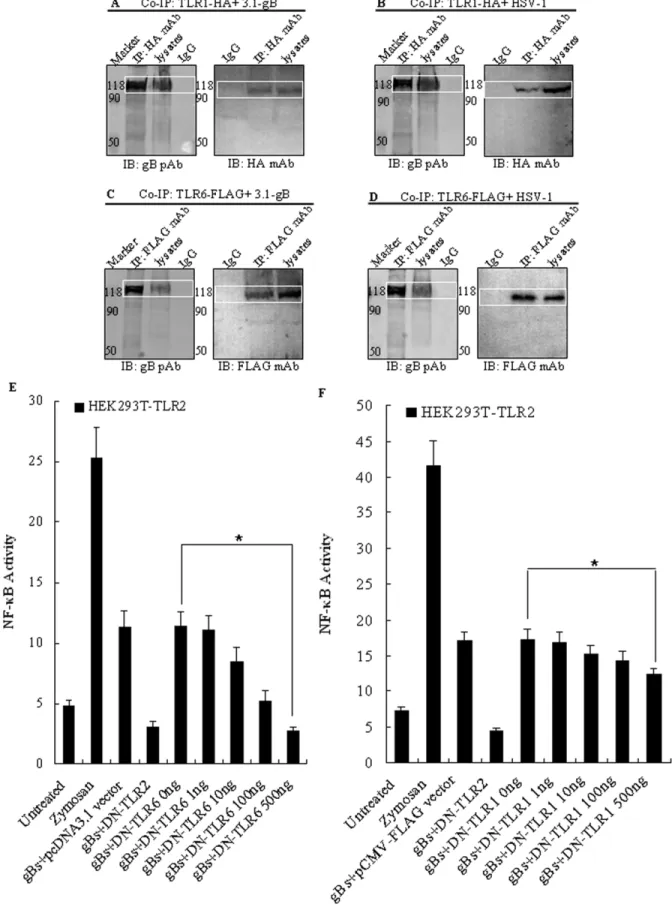 Figure 6. HSV-1-encoded gB activates NF-kB activation through TLR2 in combination with TLR6, but not TLR1