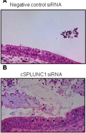Figure 7. Effect of cSPLUNC1 knock down on the histopathol- histopathol-ogy of the ET recovered from animals with NTHI-induced OM.